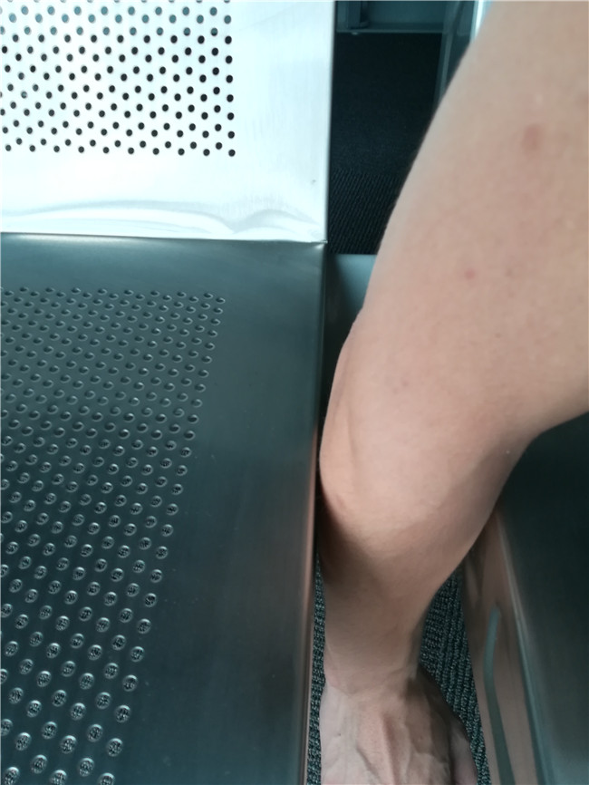 排椅为什么会夹住儿童的腿？(图3)